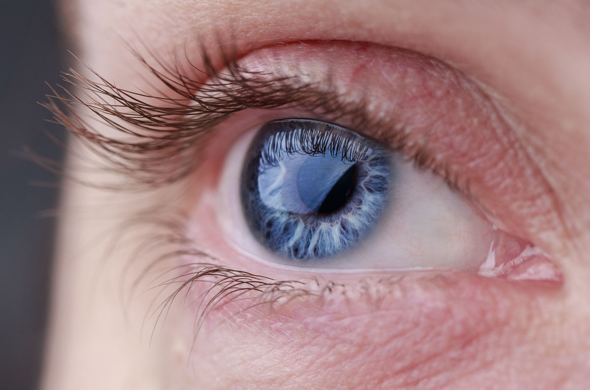 Laser Eye Surgery Risks