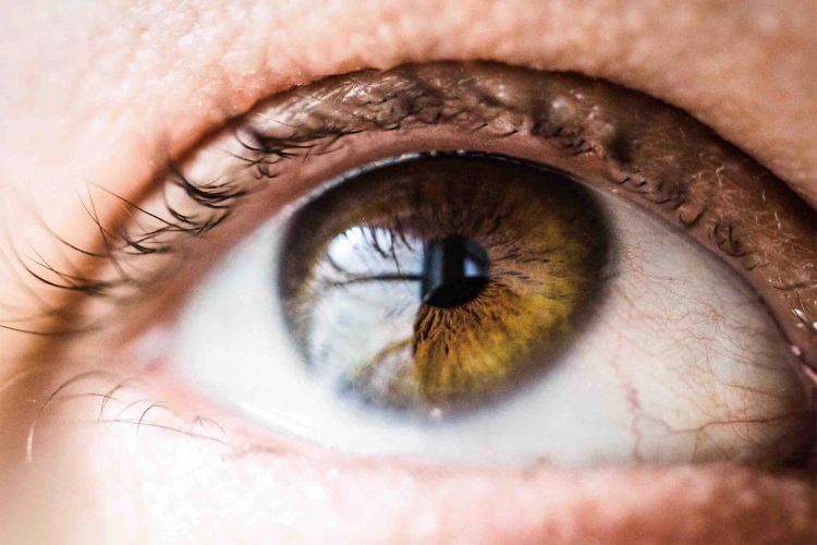 What Causes Bloodshot Eyes?